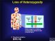 英语热词 | 杂交原始人基因多样的杂合性 Heterozygosity